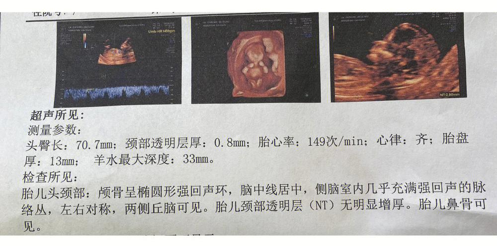 nub点【nub点：解锁身体潜能的关键】
